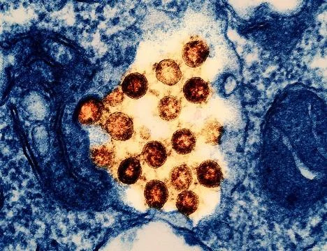  Transmission electron micrograph of SARS-CoV-2 virus particles (colorized... Stock Photos