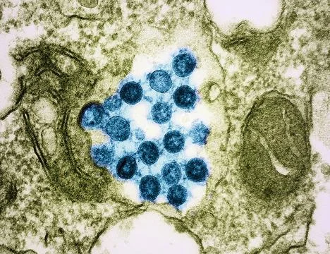  Transmission electron micrograph of SARS-CoV-2 virus particles (colorized... Stock Photos
