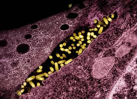  Transmission electron micrograph showing vesicular stomatitis virus (VSV)... Stock Photos