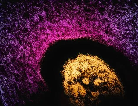  This transmission electron micrograph (TEM) revealed the ultrastructural ... Stock Photos