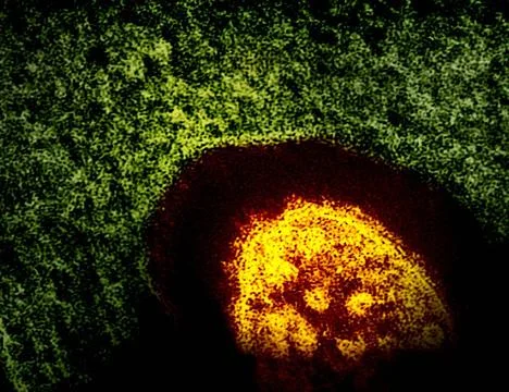  This transmission electron micrograph (TEM) revealed the ultrastructural ... Stock Photos