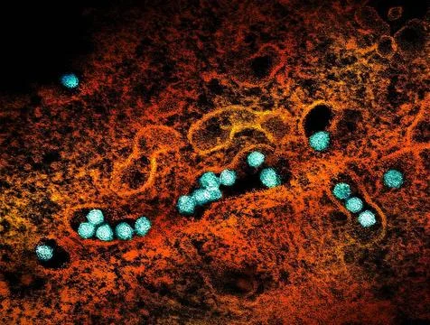  Transmission electron micrograph of West Nile virus particles (teal) repl... Stock Photos