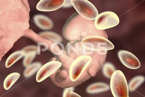 Transmission of Toxoplasma gondii parasites to fetus, medical concept Stock Illustration