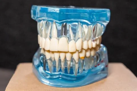 Transparent dental model with full set of teeth and visible roots on a blue base Stock Photos