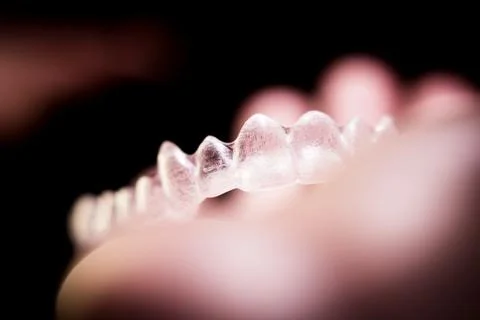 Transparent ferule retainer teeth alignment Foto stock