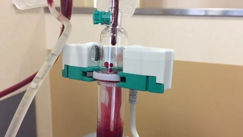 Transparent hospital dropper with blood.Concept medicine elements Stock Footage