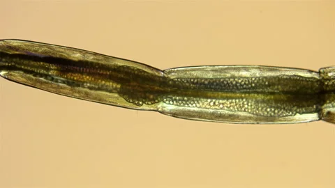 A transparent larva Chironomidae under the microscope Stock Footage 108738520