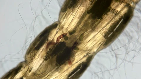 A transparent larva under the microscope Stock Footage 106639484