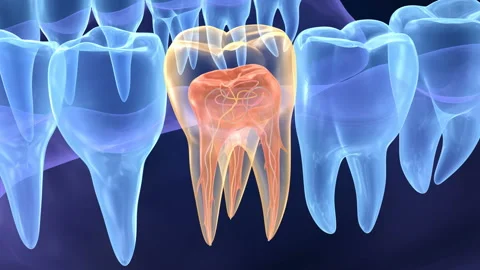 Before Endodontic Treatment Wellesley MA