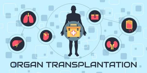 Transplantation vector illustration Stock Illustration