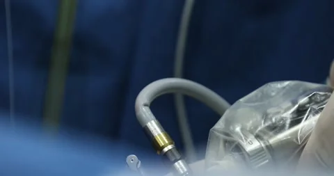 Transurethral resection of the prostate gland Stock Footage 332172891