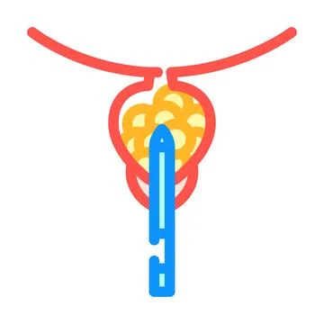 Transurethral resection prostate surgery color icon vector illustration Stock Illustration
