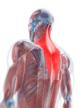 Trapezius muscle, artwork 스톡 일러스트