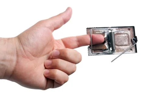 Trapped finger Foto stock