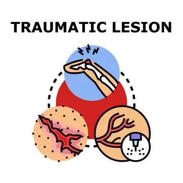 Traumatic lesion concept with first aid medical procedure Illustrazione stock