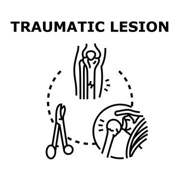 Traumatic lesion concept showing bone injury trauma Stock Illustration