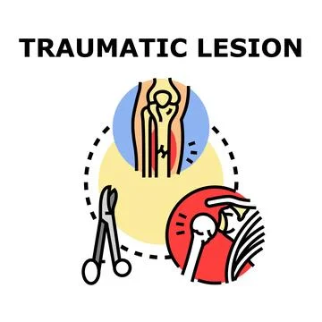Traumatic lesion concept showing bone injury trauma Stock Illustration