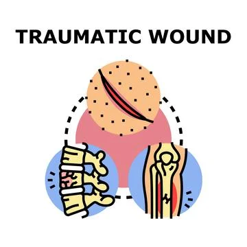 Traumatic wound concept presenting bone joint skin injury Stock Illustration