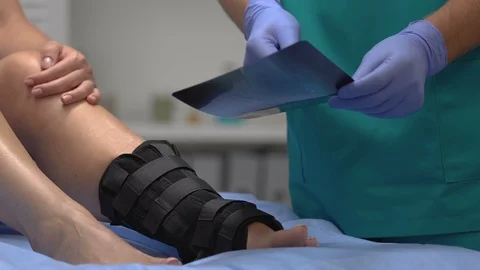 Traumatologist explaining x-ray results to patient with ankle wrap, health care Vídeos de archivo 117381113