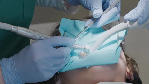Treating child tooth decay using high speed turbine drill and dental mirror 스톡 동영상 331239535