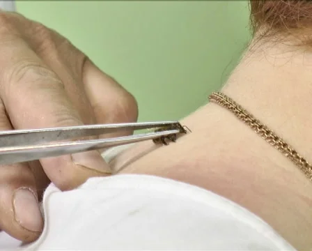 Treatment Bees Stock-Footage 40414699