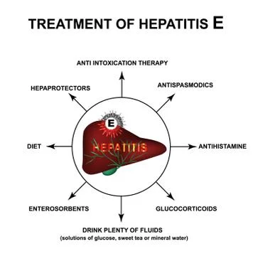 Treatment of hepatitis E. World Hepatitis Day. Infographics. Vector illustration Stock Illustration