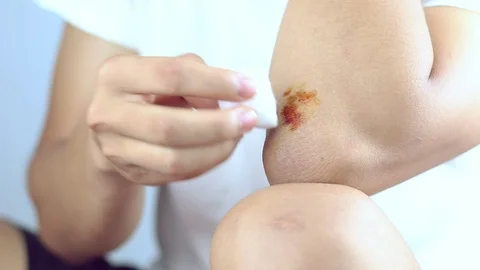 Treatment of leg wounds by himself, using patches to the wound. Caused by acc Stock Footage 91096905