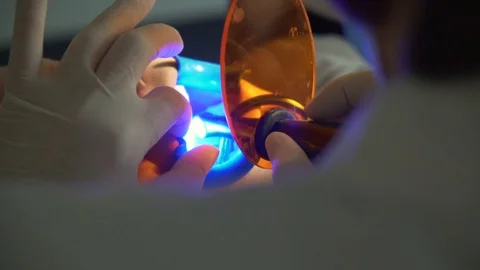 Treatment of lower bicuspid teeth, friendly doctor providing dental services Stock Footage 105571048