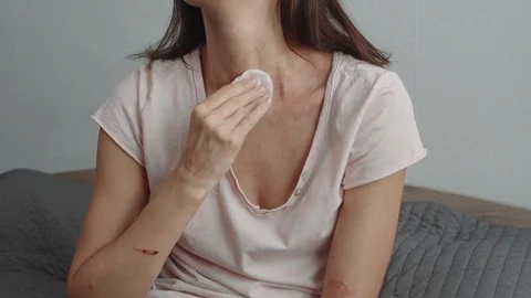 Treatment of problem skin with lotion Stock-Footage 119257026