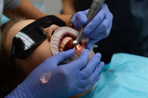 Treatment of teeth with fluoridation paste Stock Photos