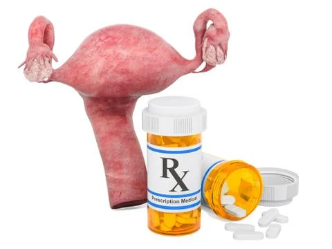 Treatment of uterus concept, 3D rendering Stock Illustration