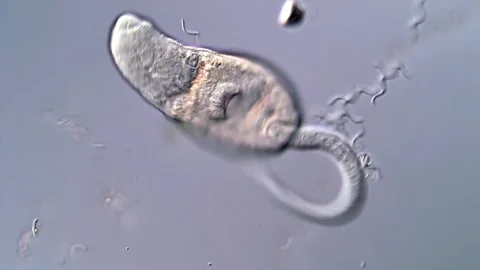 Trematode Cercariae Observed under Microscope Vídeos de archivo 317225867