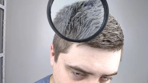 A trichologist examines a young man’s gray hair under a magnifying glass. Earlie Video stock 126407151