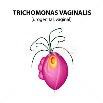 Trichomonas vaginalis structure. Trichomoniasis. Urogenital infection ...