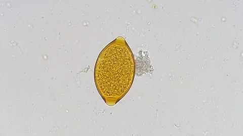 Trichuris egg under microscope, whipworm parasite egg, 400x 動画素材 318381246