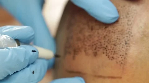 Tricopigmentation make up Stock Footage 72549327