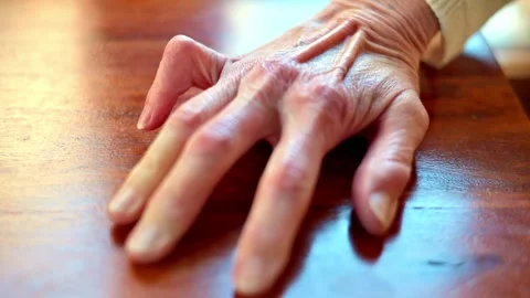 Trigger finger Stock Footage 322096548