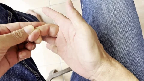 Trigger finger Stock Footage 329744504