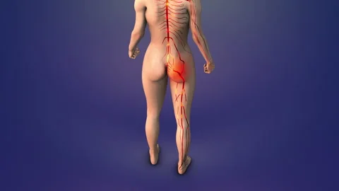 Trigger point for sciatica in human glutes Stock Footage 276224825