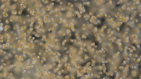 Trochophore larvae under a microscope, possibly at stage of parenchymella from Stock Footage 315216789
