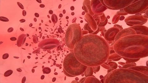 Tromb inside the blood vessel Video stock 87790231