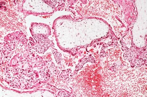 Trophoblasts Stock Photos