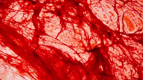 True Crime Wallpaper.Blood threads background. Hair in blood texture Stock Footage 303360114