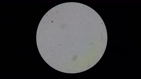 Trypanosma cruzi microscope view Stock-Footage 75051412