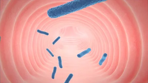 Tuberculosis bacteria pass through the bronchi Video stock 94604774