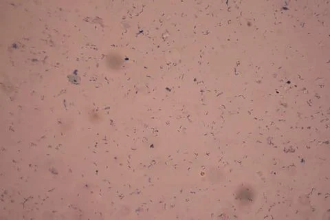 Tuberculosis bacteria under the microscop Stock Photos