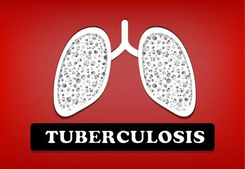 Tuberculosis, Lung Cancer in vector design Stock Illustration