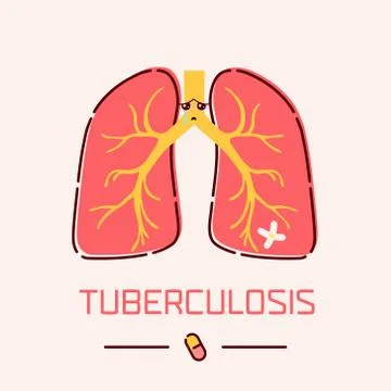 Tuberculosis lungs poster Stock Illustration
