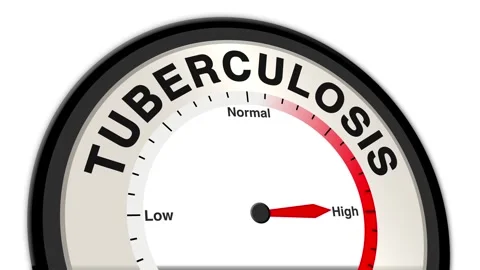 Tuberculosis Text or Word Level Low Normal High - Barometer or Tachometer Видео 308748416