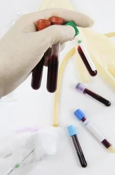 Tubes, and blood samples Stock Photos